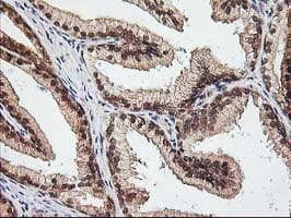 NUDT9 Antibody (clone OTI7A12)