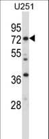 IHC-plus™ RDX / Radixin Antibody (aa466-495)