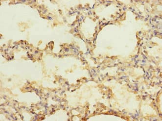 CACNA2D2 Antibody
