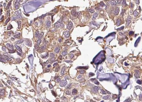 NFKBIB / IKB Beta / IKBB Antibody (phospho-Ser23)