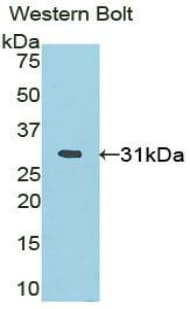 BLIMP1 / PRDM1 Antibody (aa576-813)