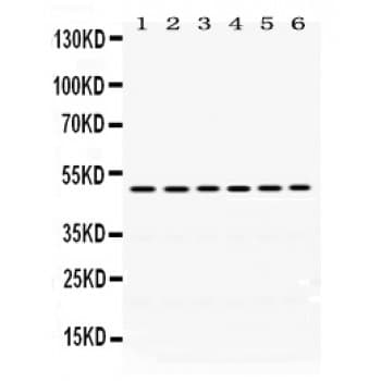 EIF4A2 Antibody (aa5-31)