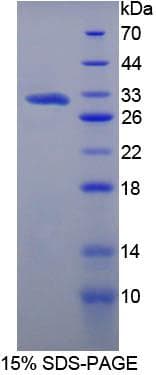 Mouse VCAN / Versican Protein (Recombinant His, N-Terminal)