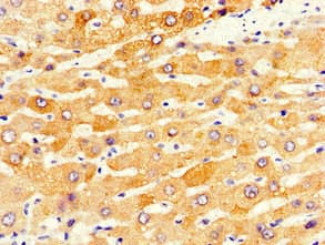 Polyclonal Rabbit anti-Human CYP1A2 Antibody (IHC)