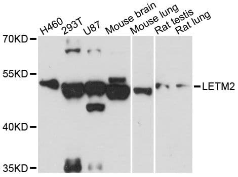 Polyclonal Rabbit anti-Human LETM2 Antibody (WB)
