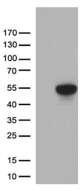 FOXP3 Antibody (clone UMAB248)