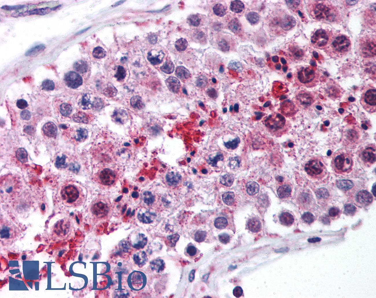 IHC-plus™ LIPE / HSL Antibody