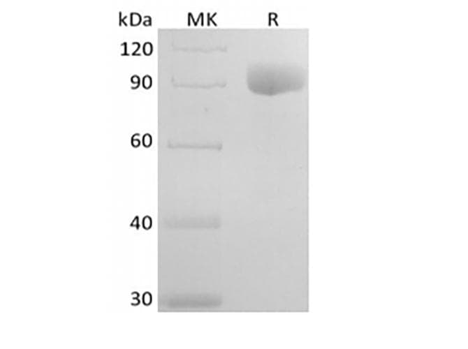 Human IL6R / IL6 Receptor Protein (Recombinant Fc, C-terminus)