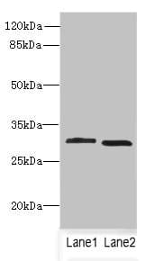 CRYBB1 Antibody