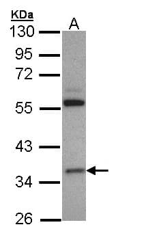 Polyclonal Rabbit anti-Human HMGCL Antibody (aa1-325, IHC, WB)