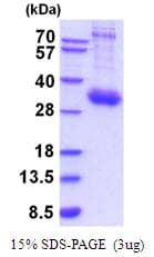 Human IL10RA Protein (Recombinant His)