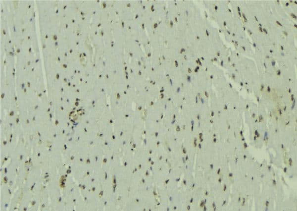UBE2E3 Antibody