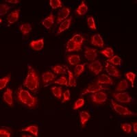 MB / Myoglobin Antibody