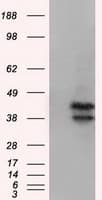 DAPK2 / DAP Kinase 2 Antibody (clone OTI1B10)