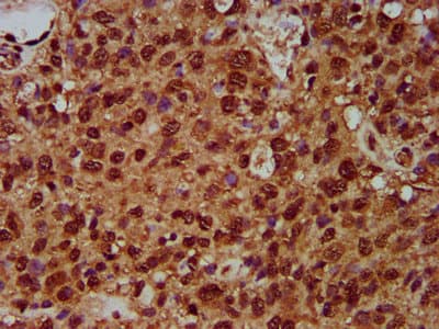 SF3B1 Antibody