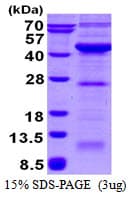 Human VPS26A / VPS26 Protein (Recombinant His)