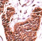 Polyclonal Rabbit anti-Human BRSK2 Antibody (aa706-736, IHC, WB)