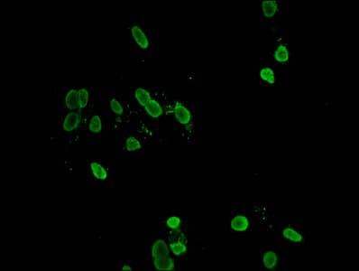 HIST1H1C Antibody