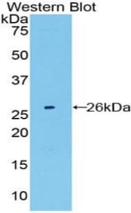 PSMB8 / LMP7 Antibody (aa75-272, Biotin)