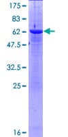 Human ASMT / HIOMT Protein (Recombinant GST)