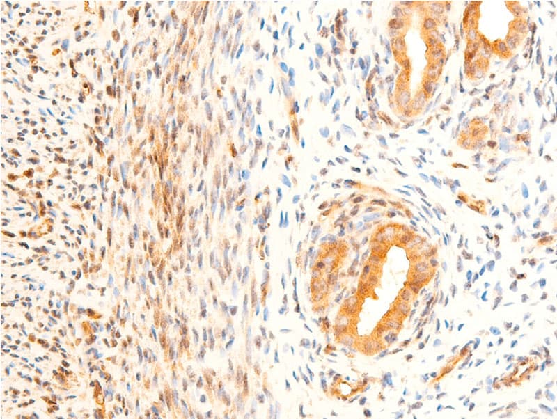 GSK3B / GSK3 Beta Antibody (phospho-Ser9)