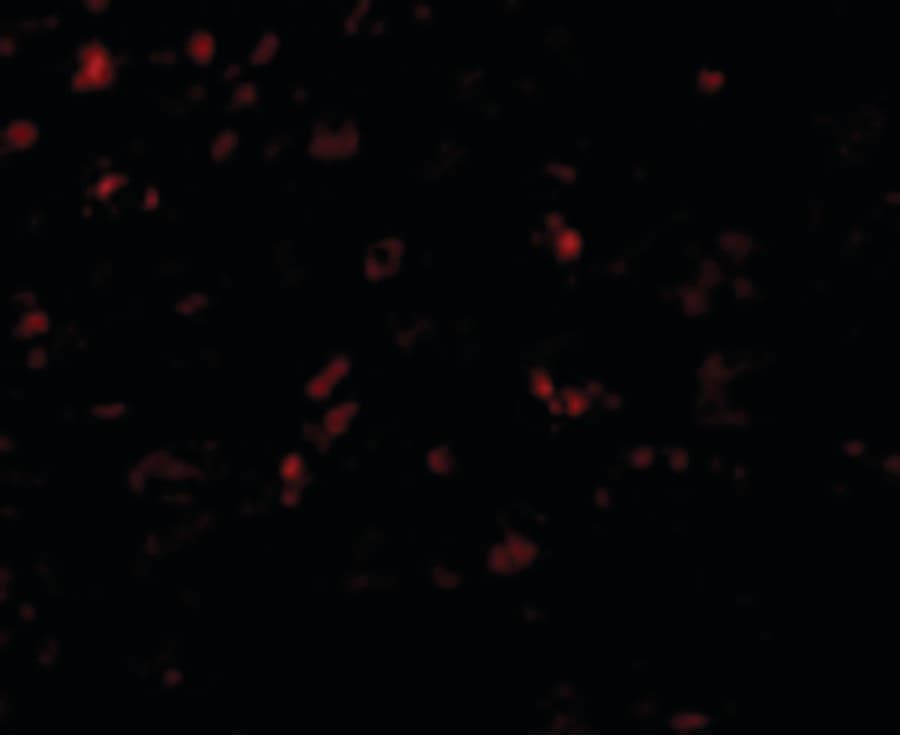 AP50 / AP2M1 Antibody
