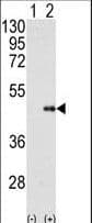 Polyclonal Rabbit anti-Human FNTB Antibody (aa6-36, IHC, WB)