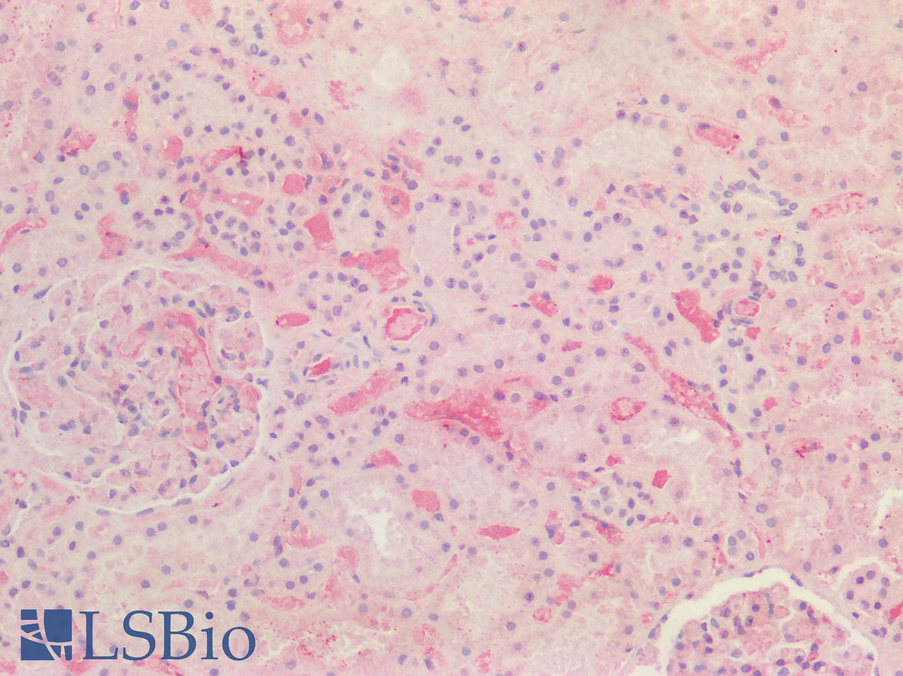 PathPlus™ Polyclonal Goat anti-Human APOE / Apolipoprotein E Antibody (aa305-317, IHC, WB)