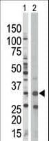 IHC-plus™ Polyclonal Rabbit anti-Human PRKAB1 / AMPK Beta 1 Antibody (aa4-34, IHC, WB)
