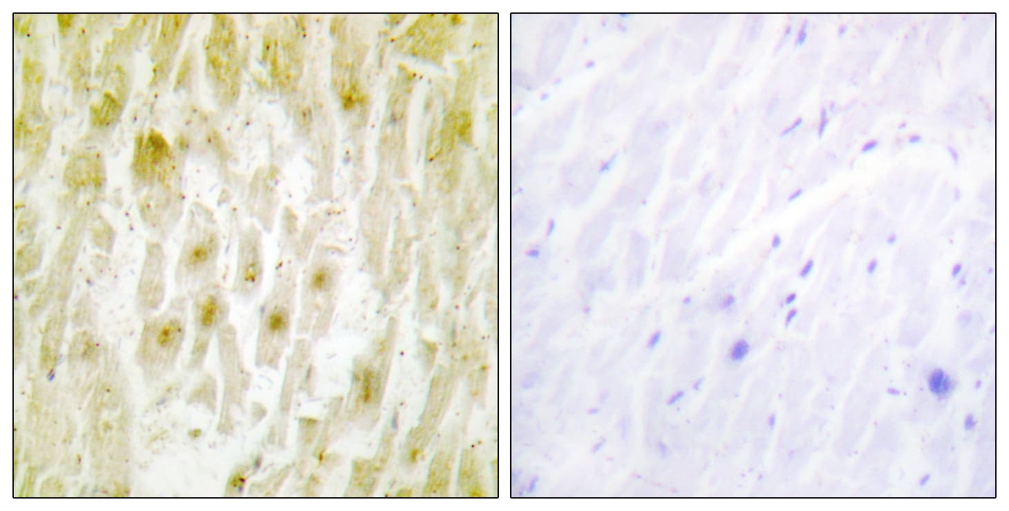 GTF2E2 Antibody (aa151-200)