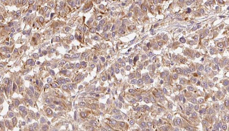 FBLN1 / Fibulin 1 Antibody