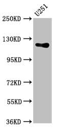 GUCY2D Antibody