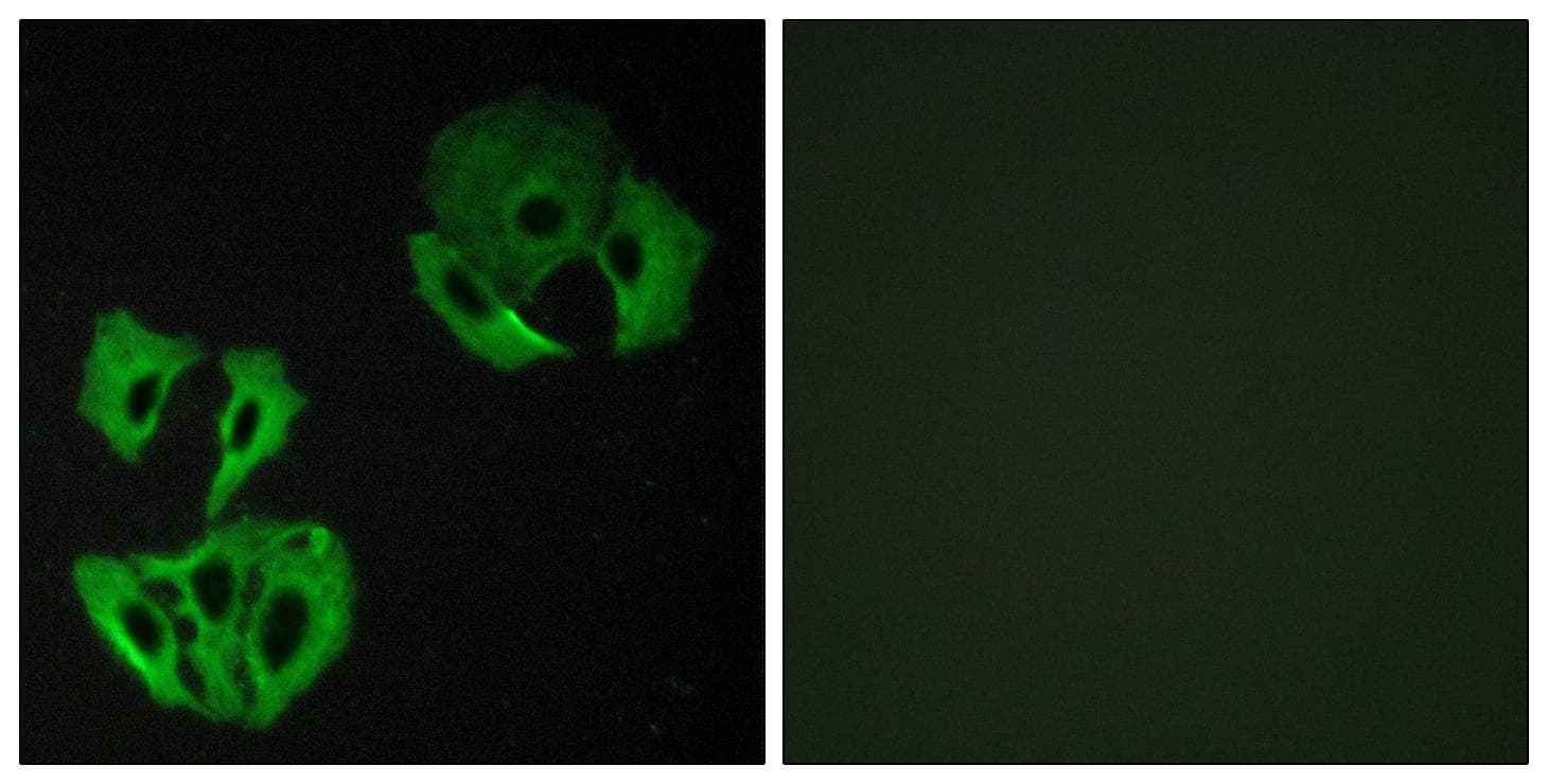 DENN / MADD Antibody