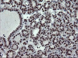 UBE2E3 Antibody (clone OTI1B4)