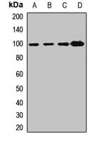 Polyclonal Rabbit anti-Human COPG / Gamma-COP Antibody (WB)