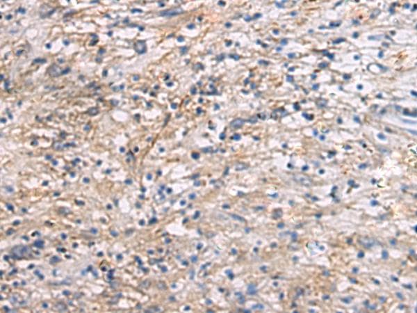 CEP89 Antibody