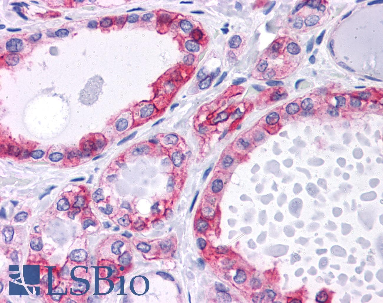 PathPlus™ CTNNB1 / Beta Catenin Antibody (clone EM-22)