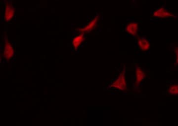 FOXO4 / AFX1 Antibody (phospho-Ser197)