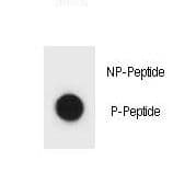 IKBKB / IKK2 / IKK Beta Antibody (phospho-Ser177)