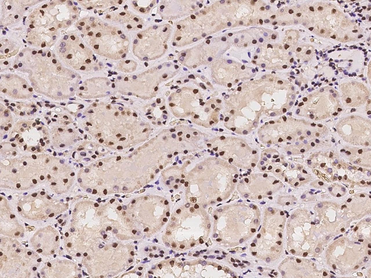 PRPF19 / PRP19 Antibody