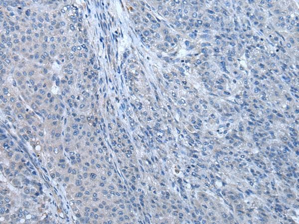 Polyclonal Rabbit anti-Human ZBTB3 Antibody (IHC, WB)