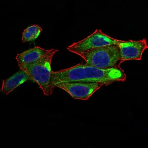 Monoclonal Mouse anti-Human RALA / RAL Antibody (clone 4G8C7, IHC, WB)