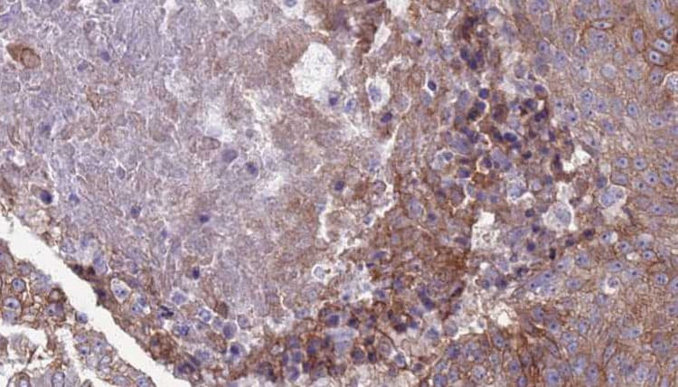 IFNAR2 Antibody