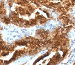 TAG-72 Antibody (clone CA72/733, Ready-to-Use)