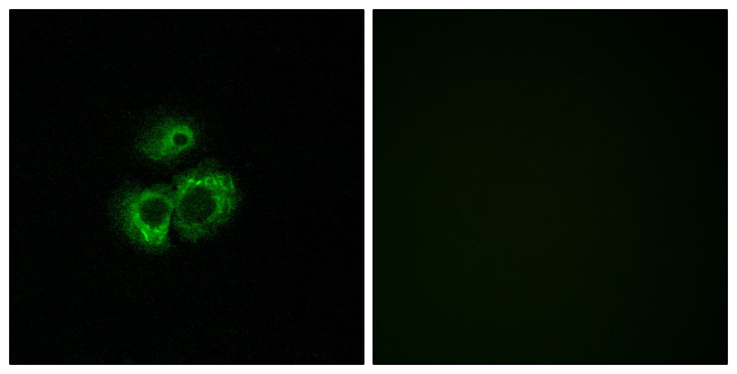 OR52D1 Antibody (aa269-318)