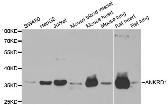 CARP / ANKRD1 Antibody