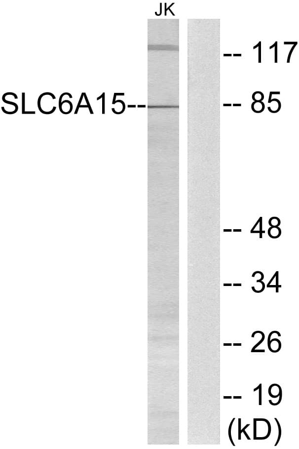 Polyclonal Rabbit anti-Human SLC6A15 / SBAT1 Antibody (aa32-81, WB)