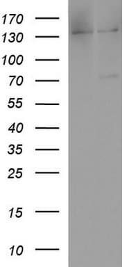 ALB / Serum Albumin Antibody (aa19-609, clone OTI4D11)