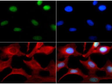 Histone H3 Antibody (Me-Lys4)