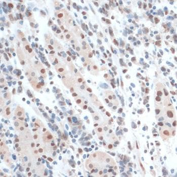 ZNF433 Antibody